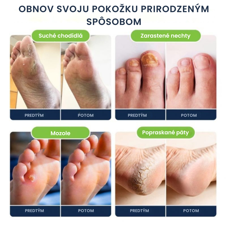 Refresher Spa Soľ do kúpeľa nôh s vybranými minerálmi a rastlinnými olejmi