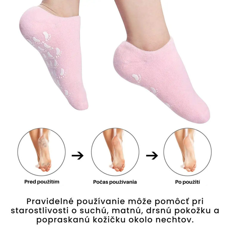 Softer Spa Gél Ponožky – S vitamínmi na starostlivosť o suchú, popraskanú pokožku