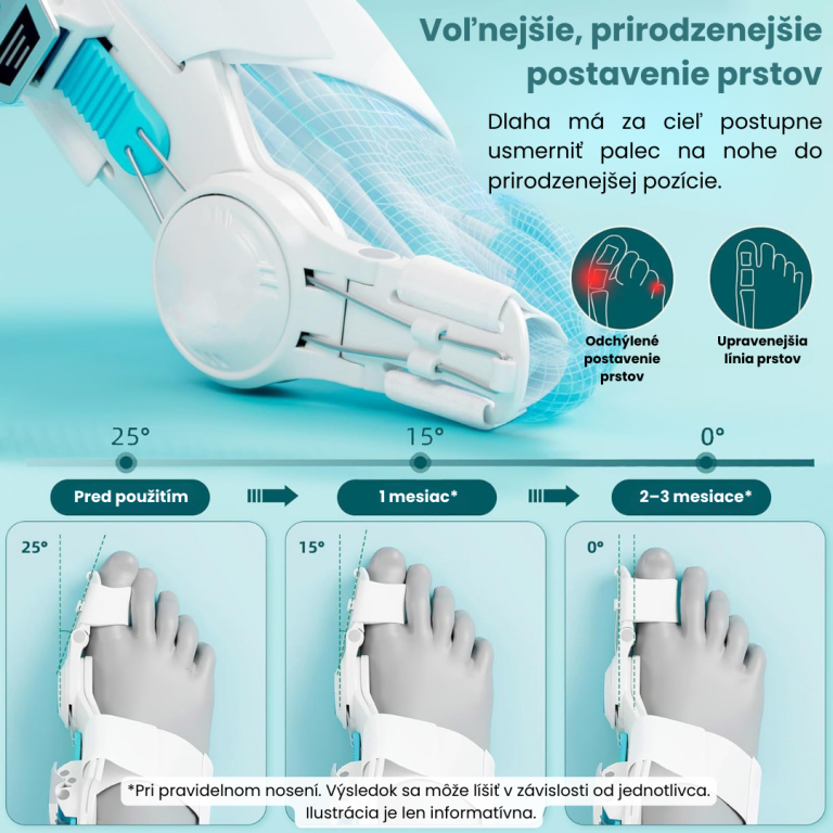 Orto Correct Korekčná dlaha na hallux a prsty