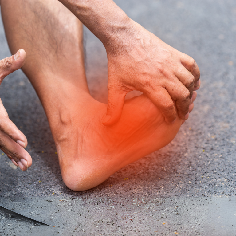 Muž trpiaci zápalom plantárnej fascie (plantárna fasciitída)